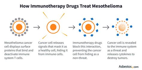 Immunotherapy for Mesothelioma